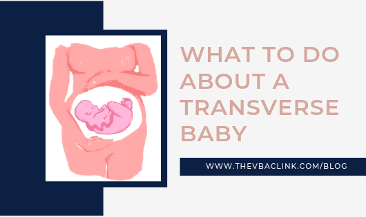 How to turn a transverse baby