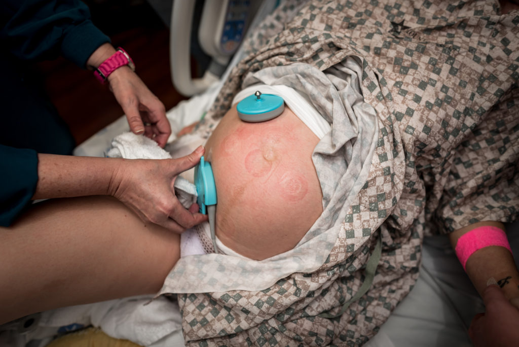 pregnant woman in labor